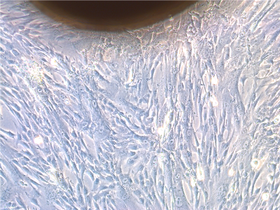 células madre mesenquimales de gelatina de Wharton