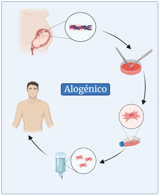 Terapia celular alogénico